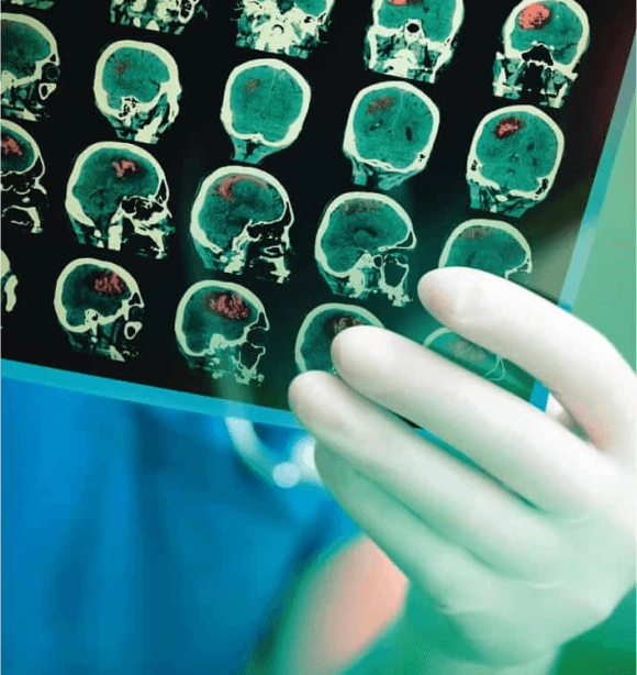 Detailed X-ray image highlighting skeletal structure with high contrast and clarity